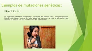 Ejemplos de mutaciones genéticas:
Hipertricosis
La hipertricosis también se denomina "síndrome del hombre lobo" . Las personas con
hipertricosis tienen exceso de vello sobre los hombros, la cara y las orejas. Los
estudios lo asocian con una reordenación del cromosoma 8.
 