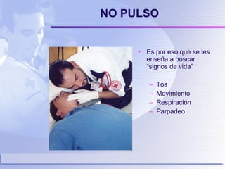 NO PULSO Es por eso que se les enseña a buscar “signos de vida” Tos Movimiento Respiración Parpadeo   