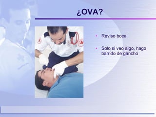 ¿OVA? Reviso boca Solo si veo algo, hago barrido de gancho 