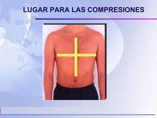 LUGAR PARA LAS COMPRESIONES 