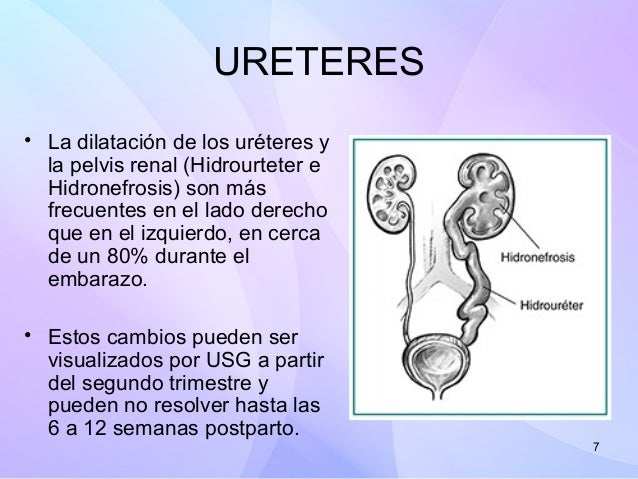 Las maquetas de entrenamiento para sheynogo del departamento de la columna vertebral comprar