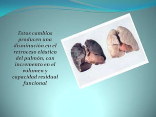 Estos cambios producen una disminución en el retroceso elástico del pulmón, con incremento en el volumen y capacidad resid...