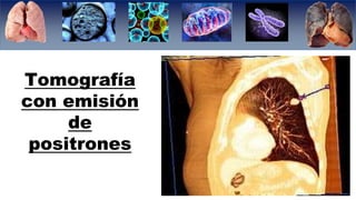 Tomografía
con emisión
de
positrones
 