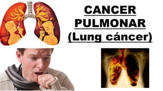 CANCER
PULMONAR
(Lung cáncer)
 