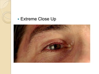    Extreme Close Up
 