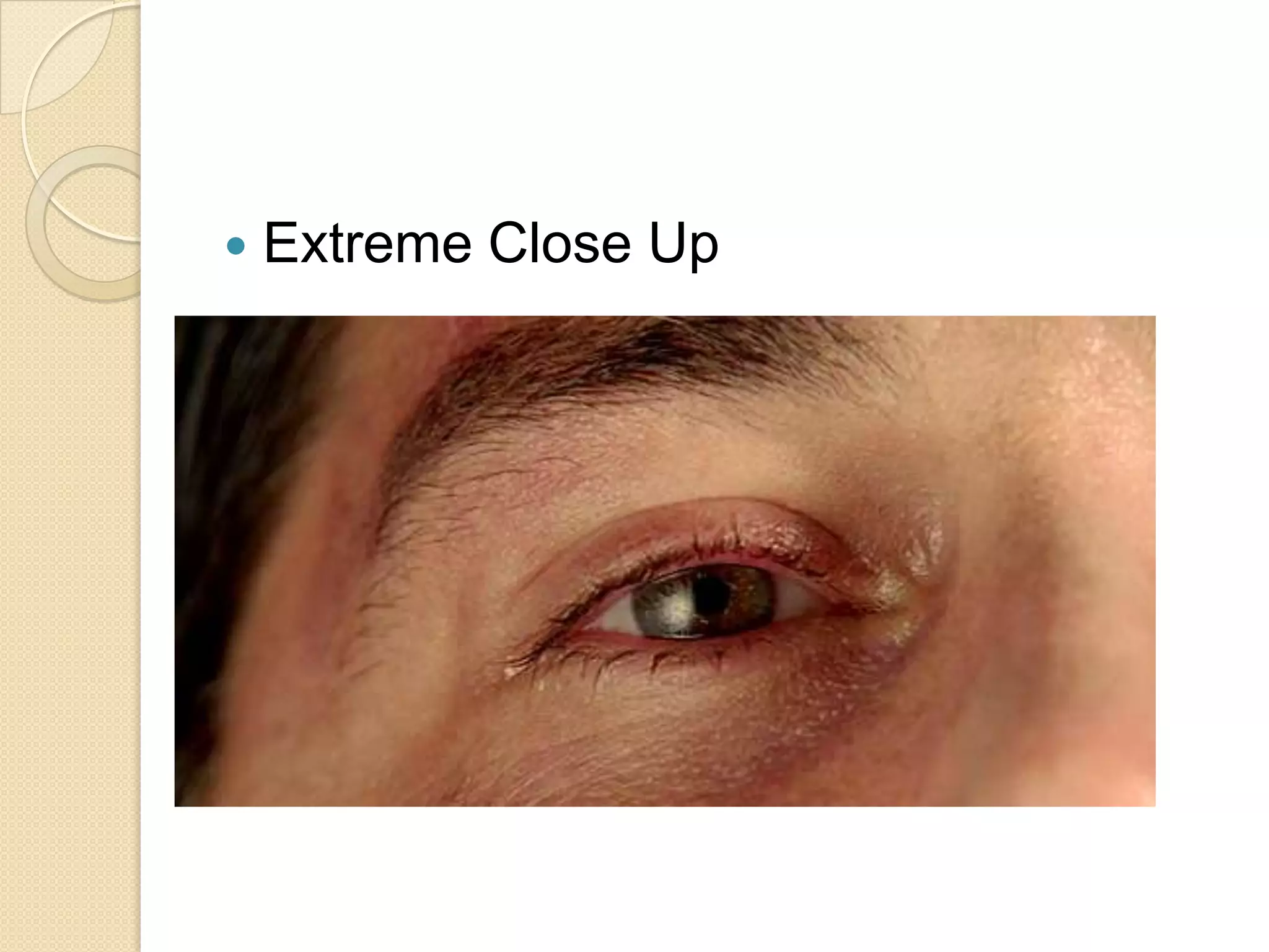    Extreme Close Up
 