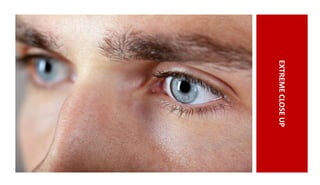 EXTREMECLOSEUP
 