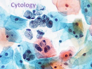 Busca mas con la palabra corregida.Para que sirven las comillas?Para profundizar la búsqueda.