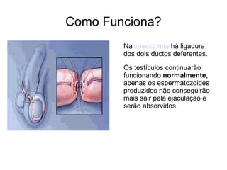 Como Funciona? Na  vasectomia  há ligadura  dos dois ductos deferentes. Os testículos continuarão funcionando  normalmente,  apenas os espermatozoides produzidos não conseguirão mais sair pela ejaculação e serão absorvidos . 