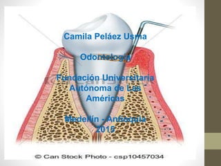 Camila Peláez Usma
Odontología
Fundación Universitaria
Autónoma de Las
Américas
Medellín - Antioquia
2015
 