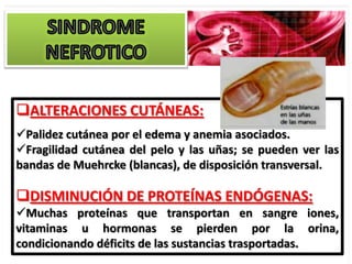 ALTERACIONES CUTÁNEAS:
Palidez cutánea por el edema y anemia asociados.
Fragilidad cutánea del pelo y las uñas; se pueden ver las
bandas de Muehrcke (blancas), de disposición transversal.

DISMINUCIÓN DE PROTEÍNAS ENDÓGENAS:
Muchas proteínas que transportan en sangre iones,
vitaminas u hormonas se pierden por la orina,
condicionando déficits de las sustancias trasportadas.
 