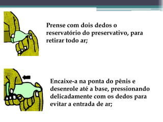 Prense com dois dedos o reservatório do preservativo, para retirar todo ar; Encaixe-a na ponta do pênis e desenrole até a base, pressionando delicadamente com os dedos para evitar a entrada de ar; 
