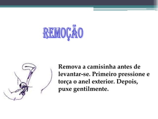 RemoçãoRemova a camisinha antes de levantar-se. Primeiro pressione e torça o anel exterior. Depois, puxe gentilmente. 