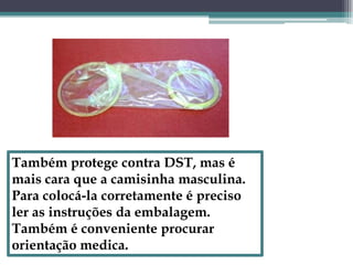 Também protege contra DST, mas é mais cara que a camisinha masculina. Para colocá-la corretamente é preciso ler as instruções da embalagem. Também é conveniente procurar orientação medica.