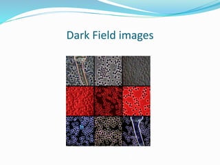 Dark Field images
 