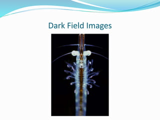 Dark Field Images
 