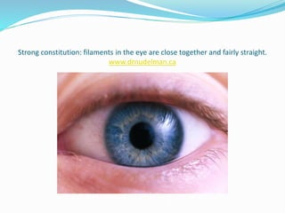 Strong constitution: filaments in the eye are close together and fairly straight.
www.drnudelman.ca
 