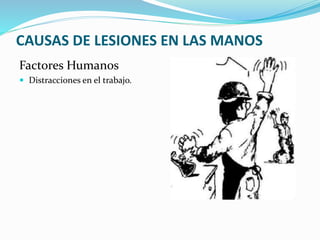 CAUSAS DE LESIONES EN LAS MANOS
Factores Humanos
 Distracciones en el trabajo.
 