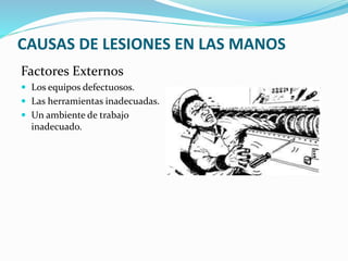 CAUSAS DE LESIONES EN LAS MANOS
Factores Externos
 Los equipos defectuosos.
 Las herramientas inadecuadas.
 Un ambiente de trabajo
inadecuado.
 
