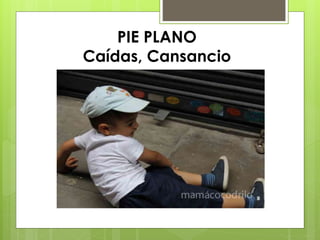 PIE PLANO 
Caídas, Cansancio 
 