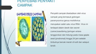 PENYEBAB PENYAKIT
CAMPAK
Penyakit campak disebabkan oleh virus
campak yang termasuk golongan
paramyxovirus genus morbilivirus
merupakan salah satu virus RNA. Virus ini
terdapat dalam darah dan secret
(cairan)nasofaring (jaringan antara
tenggorokan dan hidung) pada masa gejala
awal (prodromal) hingga 24 jam setelah
timbulnya bercak merah di kulit dan selaput
lendir.
 