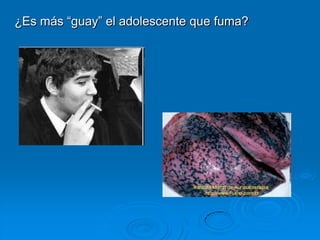 ¿Es más “guay” el adolescente que fuma?
 