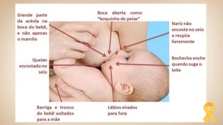 Técnicas de amamentação
 