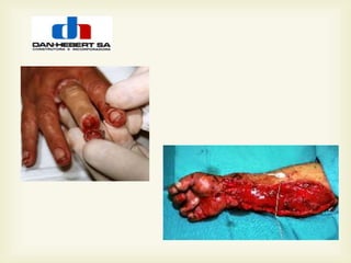 Campanha mãos e dedos dan hebert