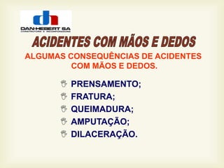  PRENSAMENTO;
 FRATURA;
 QUEIMADURA;
 AMPUTAÇÃO;
 DILACERAÇÃO.
ALGUMAS CONSEQUÊNCIAS DE ACIDENTES
COM MÃOS E DEDOS.
 