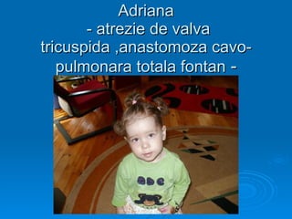 Adriana  - atrezie de valva tricuspida ,anastomoza cavo-pulmonara totala fontan  - 