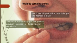 Posibles complicaciones
También al uso de las grapas que pueden
provocar lesiones al tejido dental y
periodontal
Reacciones alérgicas al látex natural del que
está diseñado el dique
 