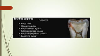 Estadios pulpares
 Pulpa sana
 Hiperemia pulpa
 Pulpitis serosa aguda
 Pulpitis ulcerosa crónica
 Pulpitis hiperplásica crónica
 Gangrena pulpar
Fusayama
 