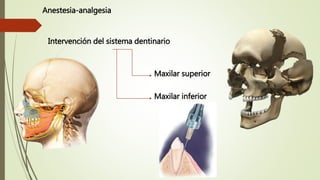 Anestesia-analgesia
Intervención del sistema dentinario
Maxilar superior
Maxilar inferior
 