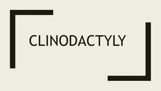 CLINODACTYLY
 