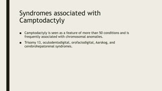 Syndromes associated with
Camptodactyly
■ Camptodactyly is seen as a feature of more than 50 conditions and is
frequently associated with chromosomal anomalies.
■ Trisomy 13, oculodentodigital, orofaciodigital, Aarskog, and
cerebrohepatorenal syndromes.
 