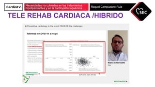 Necesidades no cubiertas en los tratamientos
hipolipemiantes y en la cardiopatía isquémica Raquel Campuzano Ruiz
TELE REHA...
