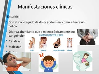 Manifestaciones clínicas
Enteritis:
• Son el inicio agudo de dolor abdominal como si fuera un
cólico.
• Diarrea abundante que a microscópicamente puede ser
sanguinolenta.
• Cefaleas.
• Malestar.
• Fiebre.
 
