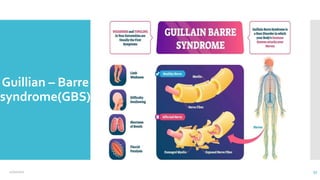 Guillian – Barre
syndrome(GBS)
12/2/2021 33
 