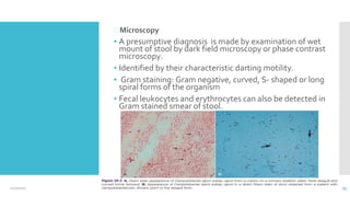 ⮚Microscopy
▪ A presumptive diagnosis is made by examination of wet
mount of stool by dark field microscopy or phase contrast
microscopy.
▪ Identified by their characteristic darting motility.
▪ Gram staining: Gram negative, curved, S- shaped or long
spiral forms of the organism
▪ Fecal leukocytes and erythrocytes can also be detected in
Gram stained smear of stool.
12/2/2021 35
 