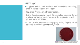 ▪ Blood agar:
● C. jejuni and C. coli produce non-haemolytic spreading,
droplet-like colonies on blood agar.
▪ Improved Preston blood-free medium:
• C. jejuni produces grey, moist, flat-spreading colonies. Some
strains may have a green hue or a dry appearance with or
without a metallic sheen.
• C. coli usually produces creamy-grey, moist, slightly raised
colonies. A swarming growth may occur.
12/2/2021 41
 