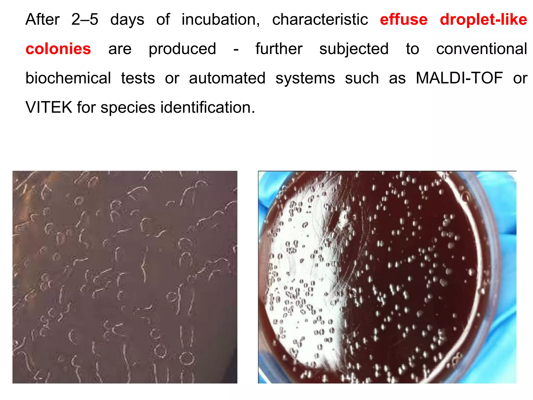 After 2–5 days of incubation, characteristic effuse droplet-like
colonies are produced - further subjected to conventional
biochemical tests or automated systems such as MALDI-TOF or
VITEK for species identification.
 
