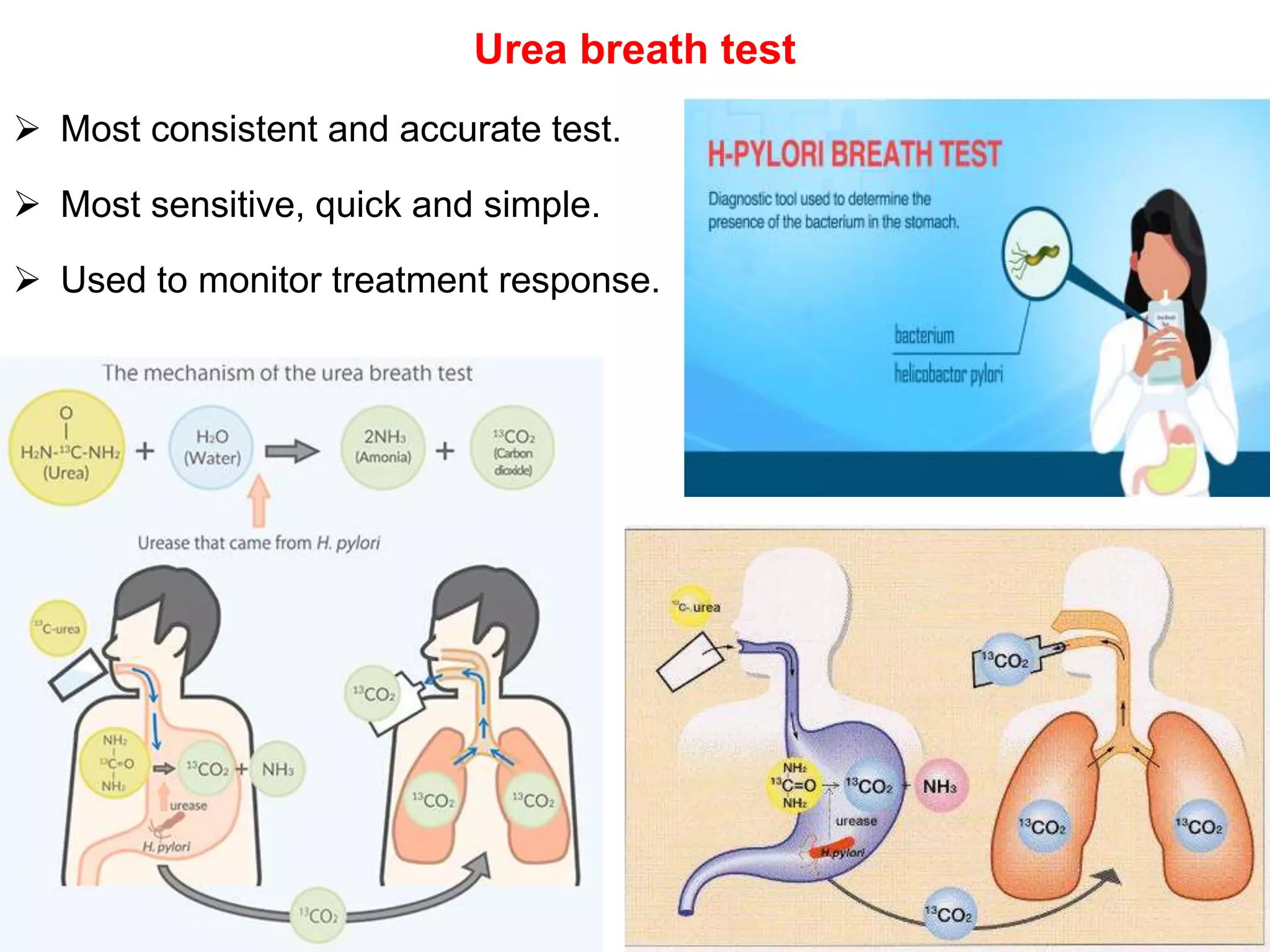 Urea breath test
 Most consistent and accurate test.
 Most sensitive, quick and simple.
 Used to monitor treatment response.
 