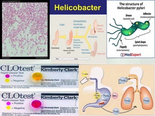 Helicobacter
 