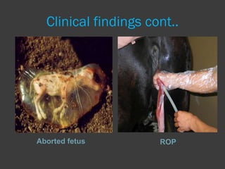 Clinical findings cont..




Aborted fetus         ROP
 