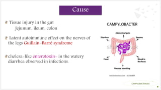 Your Logo or Name Here
Tissue injury in the gut
Jejunum, ileum, colon
CAMPYLOBACTERIOSIS
Cause
Latent autoimmune effect on the nerves of
the legs Guillain–Barré syndrome
cholera-like enterotoxin- in the watery
diarrhea observed in infections.
 