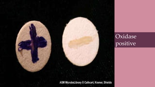 Diagnosis
• Gram staining and microscopy
•Oxidase Test
•Immunoassay Test
•Culture
Oxidase
positive
 