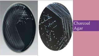 Diagnosis
• Gram staining and microscopy
•Oxidase Test
•Immunoassay Test
•Culture
Arrow shows
C. jejuni
Charcoal
Agar
 