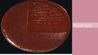 Diagnosis
• Gram staining and microscopy
•Oxidase Test
•Immunoassay Test
•Culture
Arrow shows
C. jejuni
Charcoal
Agar
Blood Agar
 