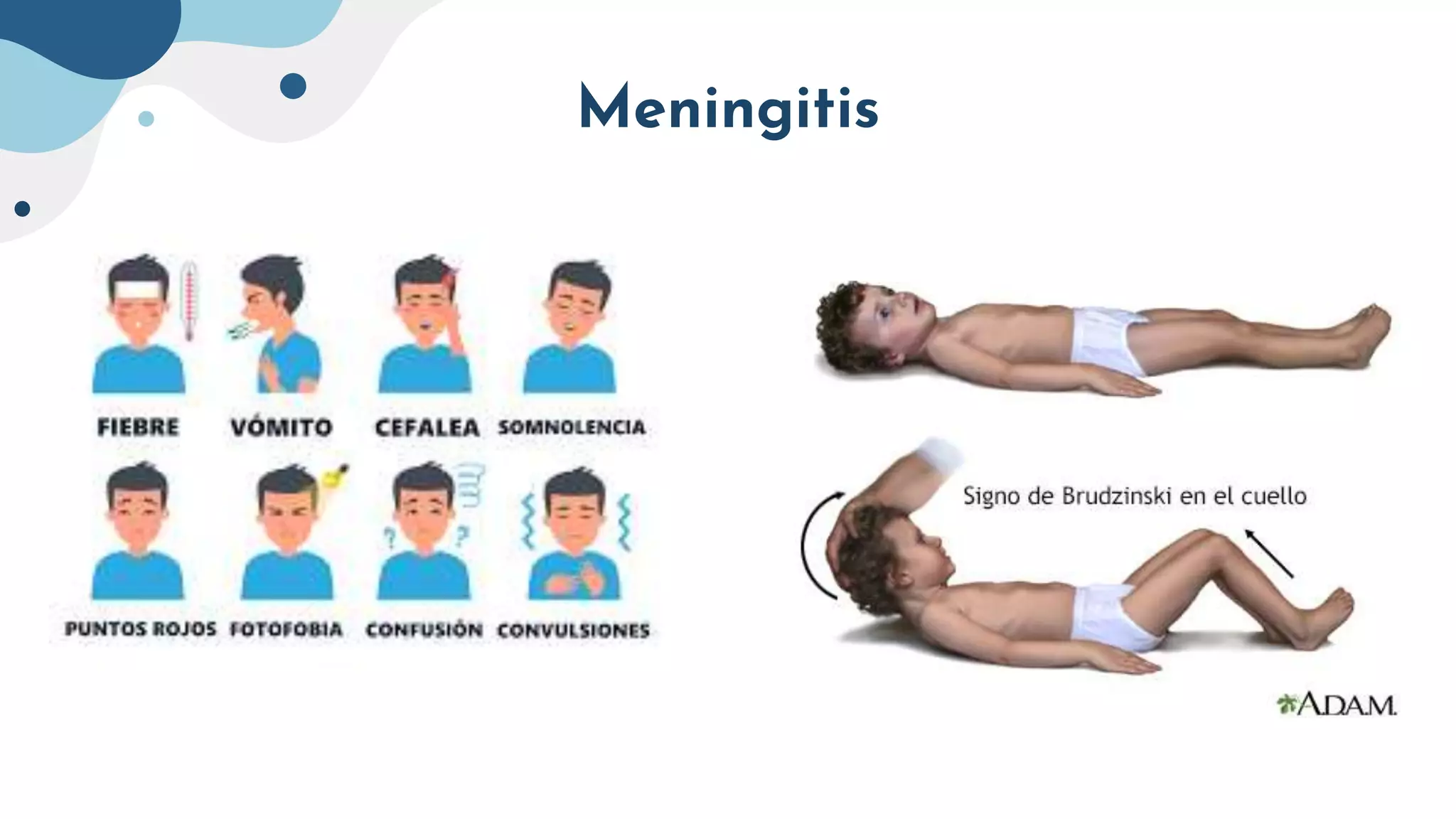 Meningitis