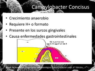 Campylobacter Concisus 
• Crecimiento anaerobio 
• Requiere H+ o formato 
• Presente en los surcos gingivales 
• Causa enfermedades gastrointestinales 
Elmer W. Koneman. Diagnóstico microbiológico Texto y Atlas en color. 6° Edición. 
USA:200 
 